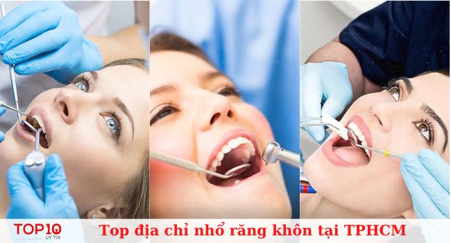 Top 10 địa chỉ nhổ răng khôn uy tín, an toàn tại TPHCM